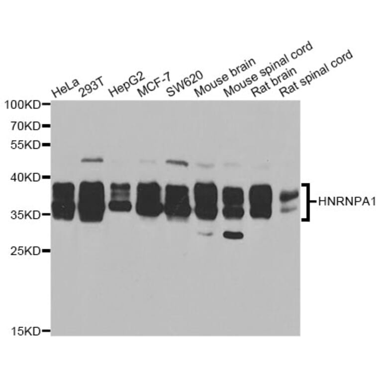 Western Blot - Anti-HNRNPA1 Antibody (A12446) - Antibodies.com