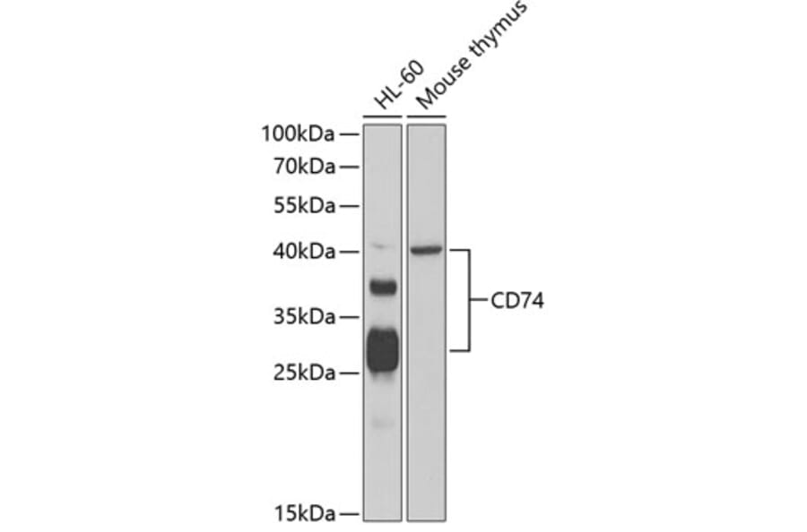 Western Blot - Anti-CD74 Antibody (A87640) - Antibodies.com