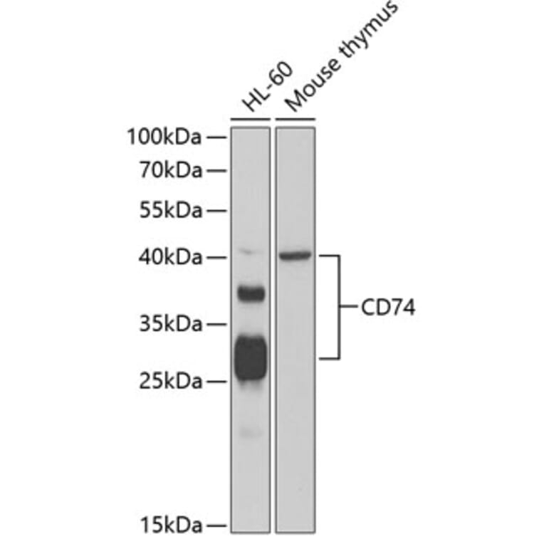 Western Blot - Anti-CD74 Antibody (A87640) - Antibodies.com