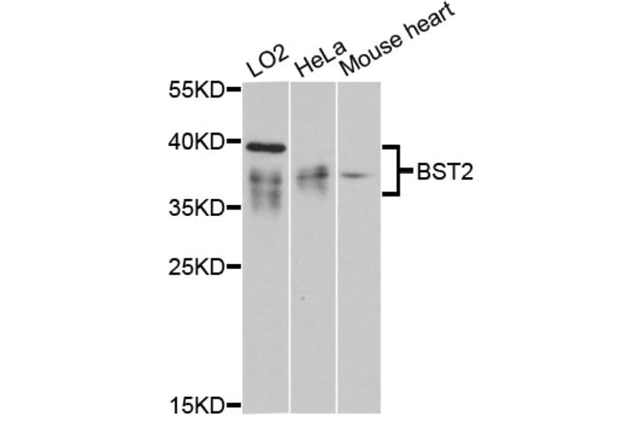 Western Blot - Anti-BST2/Tetherin Antibody (A87641) - Antibodies.com