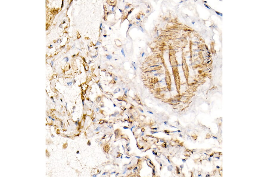 Immunohistochemistry - Anti-BST2/Tetherin Antibody (A87641) - Antibodies.com