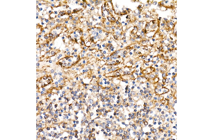 Immunohistochemistry - Anti-BST2/Tetherin Antibody (A87641) - Antibodies.com