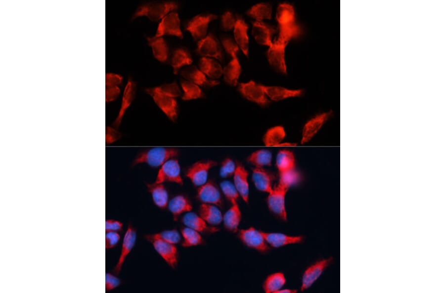 Immunofluorescence - Anti-BST2/Tetherin Antibody (A87641) - Antibodies.com