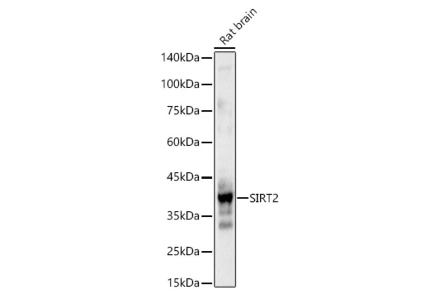 Western Blot - Anti-SIRT2 Antibody (A87642) - Antibodies.com