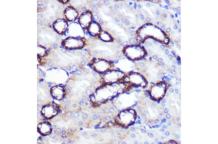 Immunohistochemistry - Anti-SIRT2 Antibody (A87642) - Antibodies.com
