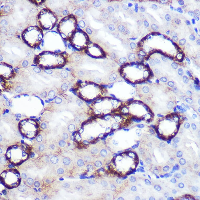 Immunohistochemistry - Anti-SIRT2 Antibody (A87642) - Antibodies.com