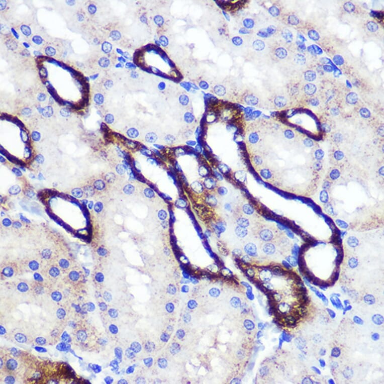 Immunohistochemistry - Anti-SIRT2 Antibody (A87642) - Antibodies.com
