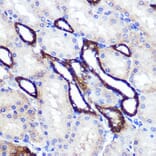 Immunohistochemistry - Anti-SIRT2 Antibody (A87642) - Antibodies.com