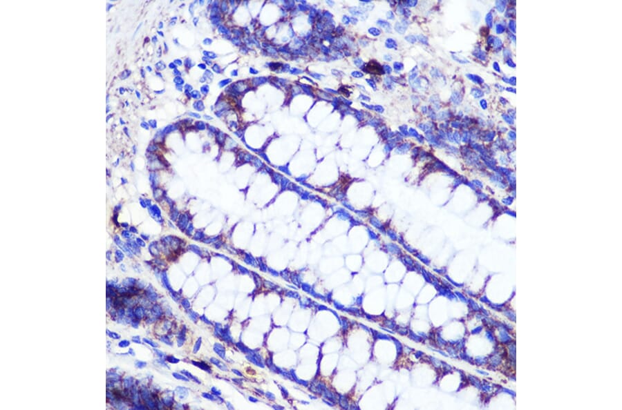 Immunohistochemistry - Anti-SIRT2 Antibody (A87642) - Antibodies.com
