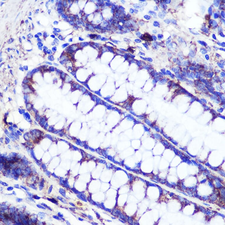 Immunohistochemistry - Anti-SIRT2 Antibody (A87642) - Antibodies.com