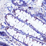 Immunohistochemistry - Anti-SIRT2 Antibody (A87642) - Antibodies.com