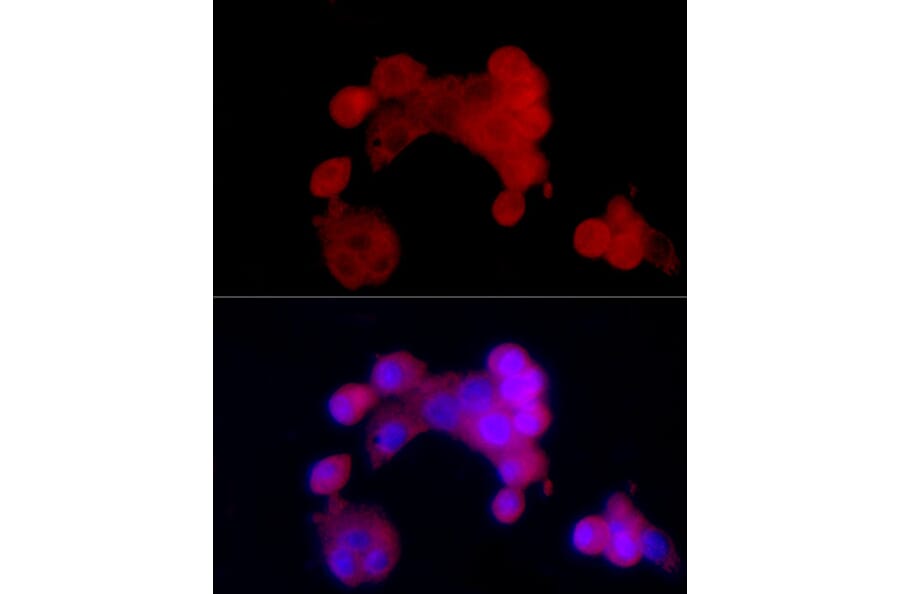 Immunofluorescence - Anti-SIRT2 Antibody (A87642) - Antibodies.com