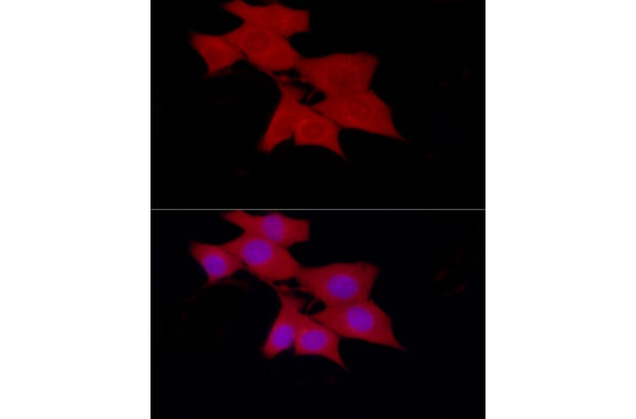 Immunofluorescence - Anti-SIRT2 Antibody (A87642) - Antibodies.com