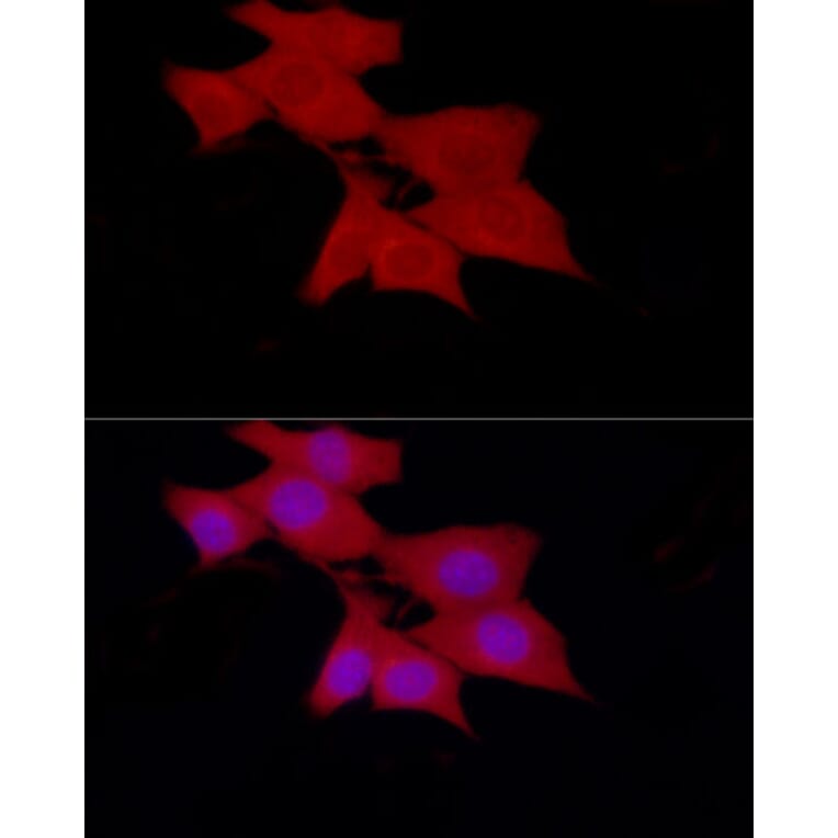 Immunofluorescence - Anti-SIRT2 Antibody (A87642) - Antibodies.com