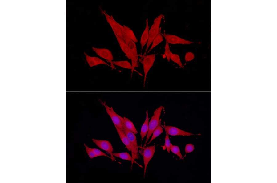 Immunofluorescence - Anti-SIRT2 Antibody (A87642) - Antibodies.com