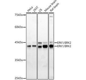 Western Blot - Anti-ERK1 + ERK2 Antibody (A87643) - Antibodies.com