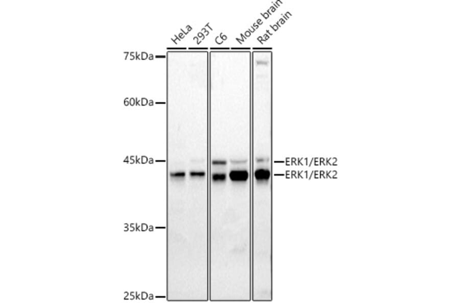 Western Blot - Anti-ERK1 + ERK2 Antibody (A87643) - Antibodies.com