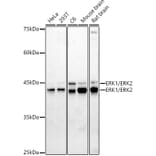 Western Blot - Anti-ERK1 + ERK2 Antibody (A87643) - Antibodies.com