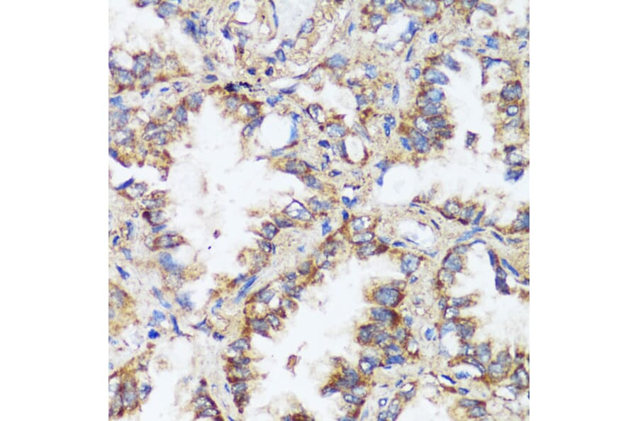 Immunohistochemistry - Anti-ERK1 + ERK2 Antibody (A87643) - Antibodies.com