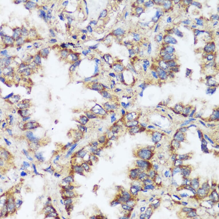 Immunohistochemistry - Anti-ERK1 + ERK2 Antibody (A87643) - Antibodies.com
