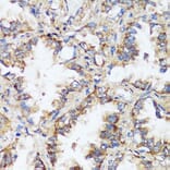 Immunohistochemistry - Anti-ERK1 + ERK2 Antibody (A87643) - Antibodies.com