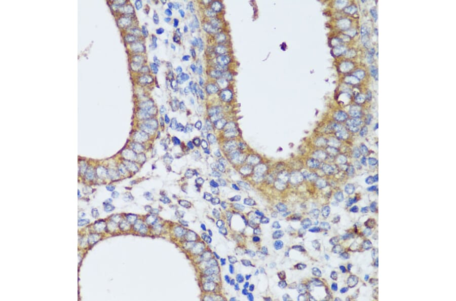 Immunohistochemistry - Anti-ERK1 + ERK2 Antibody (A87643) - Antibodies.com