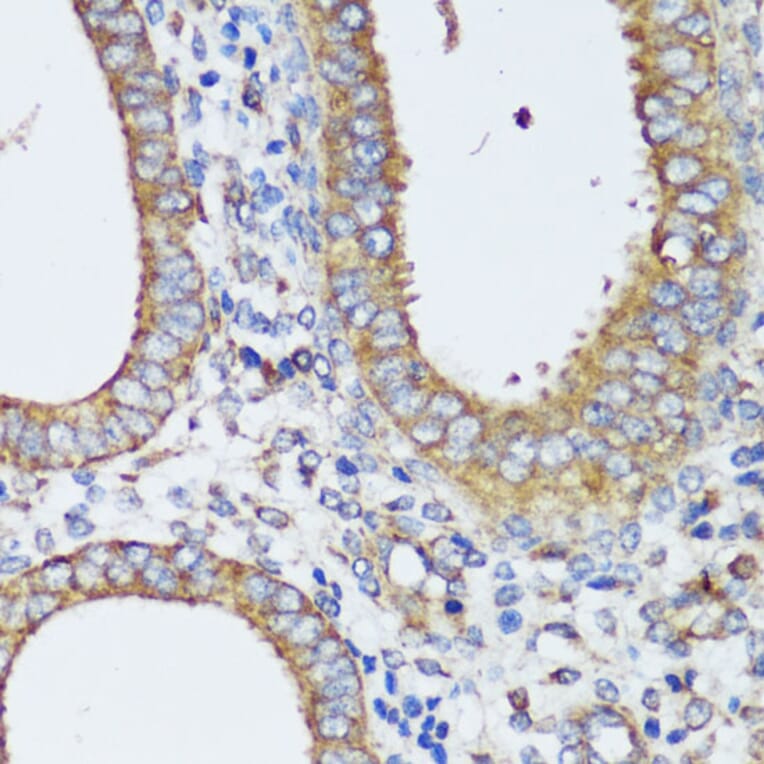 Immunohistochemistry - Anti-ERK1 + ERK2 Antibody (A87643) - Antibodies.com