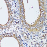 Immunohistochemistry - Anti-ERK1 + ERK2 Antibody (A87643) - Antibodies.com