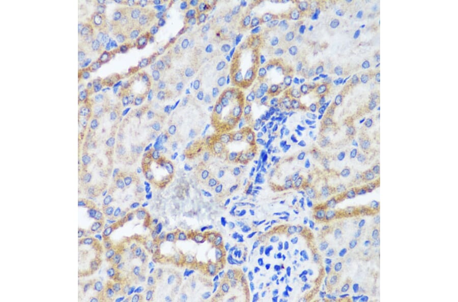 Immunohistochemistry - Anti-ERK1 + ERK2 Antibody (A87643) - Antibodies.com