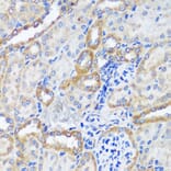 Immunohistochemistry - Anti-ERK1 + ERK2 Antibody (A87643) - Antibodies.com
