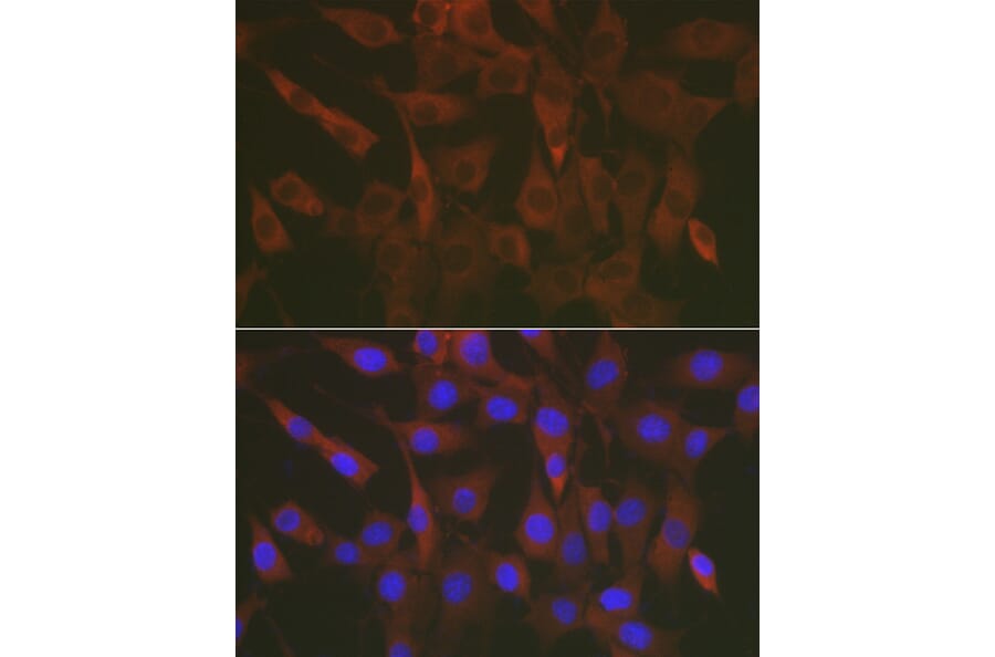 Immunofluorescence - Anti-ERK1 + ERK2 Antibody (A87643) - Antibodies.com
