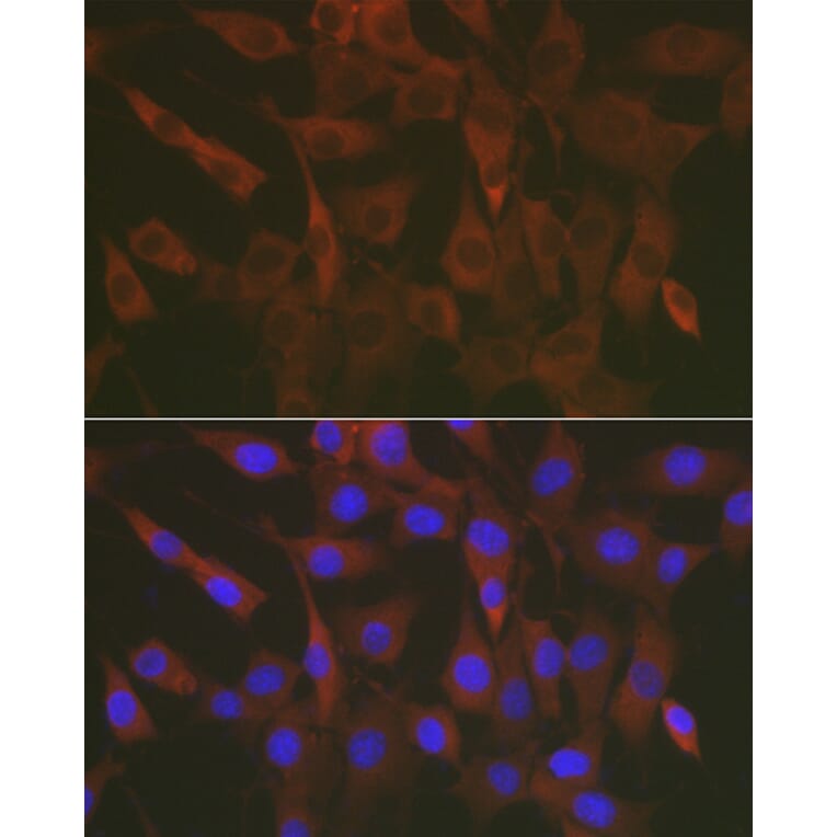 Immunofluorescence - Anti-ERK1 + ERK2 Antibody (A87643) - Antibodies.com