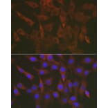 Immunofluorescence - Anti-ERK1 + ERK2 Antibody (A87643) - Antibodies.com