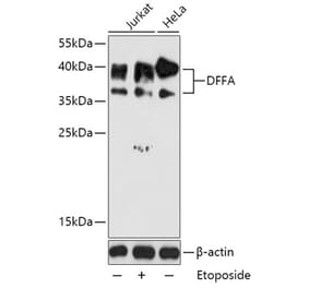 Western Blot - Anti-ICAD Antibody (A87645) - Antibodies.com