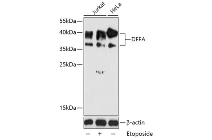Western Blot - Anti-ICAD Antibody (A87645) - Antibodies.com