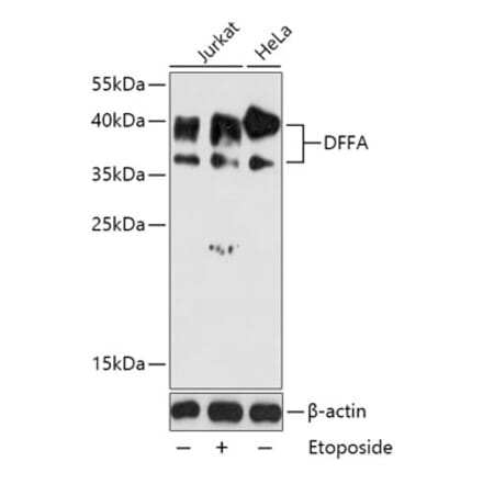 Western Blot - Anti-ICAD Antibody (A87645) - Antibodies.com