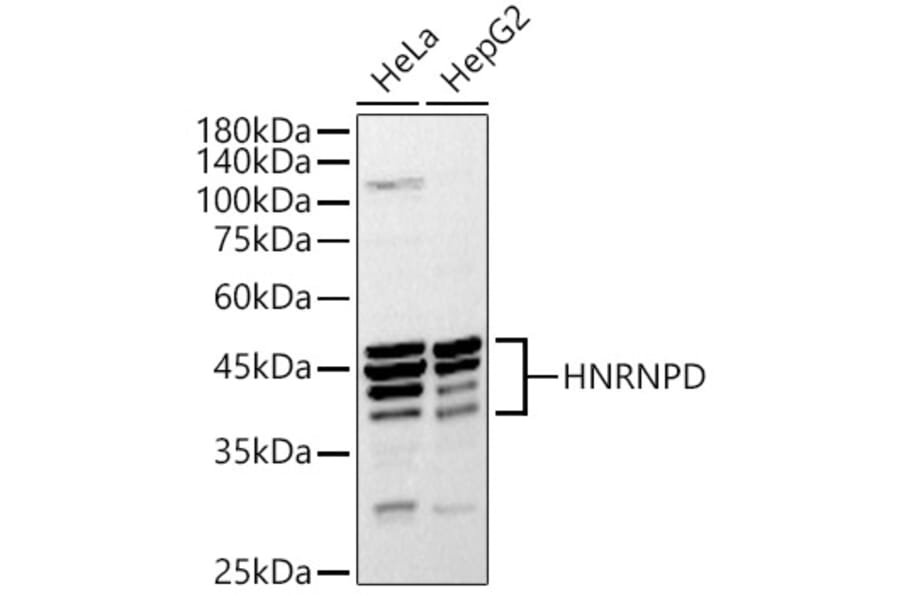 Western Blot - Anti-hnRNP D/AUF1 Antibody (A87646) - Antibodies.com