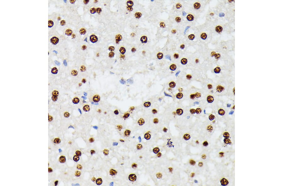 Immunohistochemistry - Anti-hnRNP D/AUF1 Antibody (A87646) - Antibodies.com