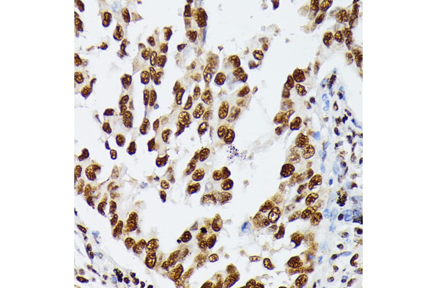 Immunohistochemistry - Anti-hnRNP D/AUF1 Antibody (A87646) - Antibodies.com