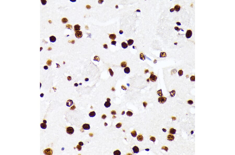 Immunohistochemistry - Anti-hnRNP D/AUF1 Antibody (A87646) - Antibodies.com