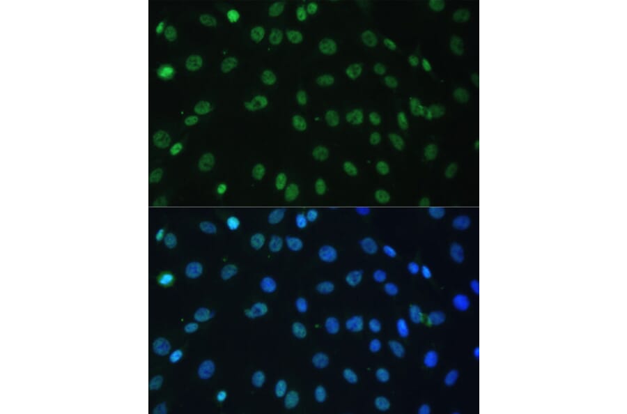 Immunofluorescence - Anti-hnRNP D/AUF1 Antibody (A87646) - Antibodies.com