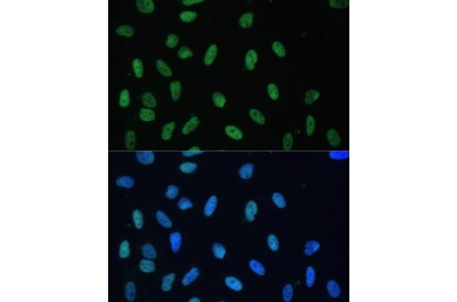 Immunofluorescence - Anti-hnRNP D/AUF1 Antibody (A87646) - Antibodies.com