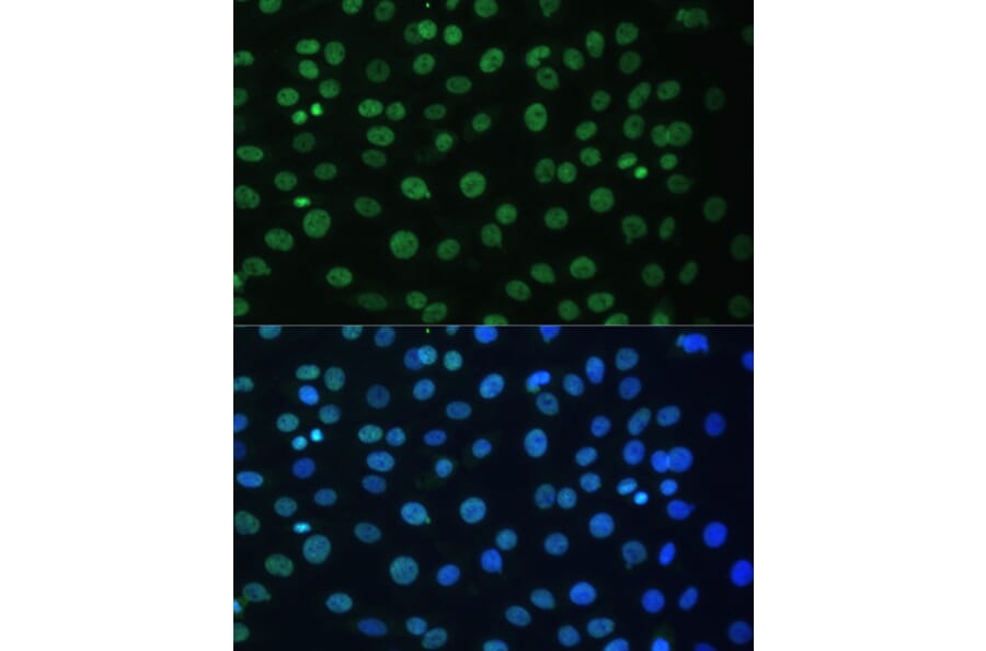 Immunofluorescence - Anti-hnRNP D/AUF1 Antibody (A87646) - Antibodies.com