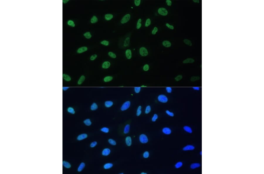 Immunofluorescence - Anti-hnRNP D/AUF1 Antibody (A87646) - Antibodies.com