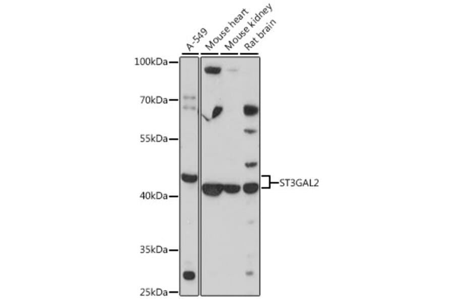 Western Blot - Anti-ST3GAL2 Antibody (A13733) - Antibodies.com