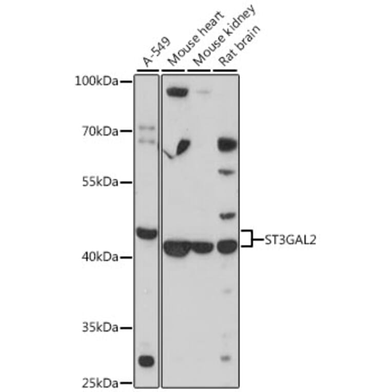 Western Blot - Anti-ST3GAL2 Antibody (A13733) - Antibodies.com