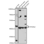 Western Blot - Anti-ST3GAL2 Antibody (A13733) - Antibodies.com