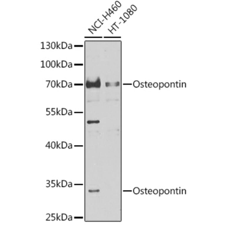 Western Blot - Anti-Osteopontin Antibody (A87648) - Antibodies.com