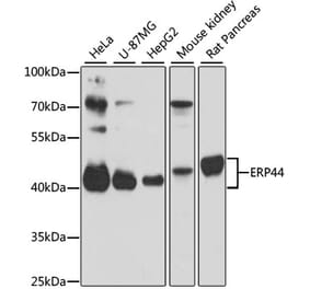 Western Blot - Anti-TXNDC4 Antibody (A87649) - Antibodies.com