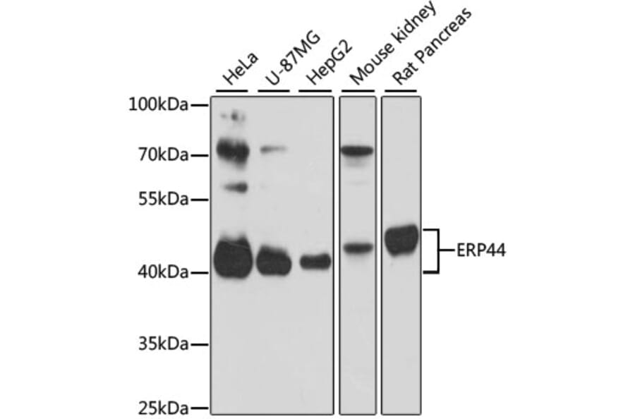Western Blot - Anti-TXNDC4 Antibody (A87649) - Antibodies.com